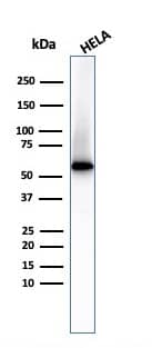 Fascin Antibody (FSCN1/417) - IHC-Prediluted Western Blot: Fascin Antibody (FSCN1/417) - IHC-Prediluted [NBP2-48311] -