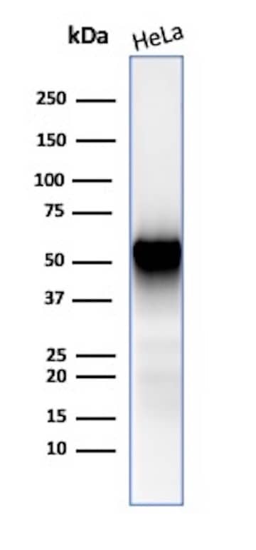 Fascin Antibody (FSCN1/417) - IHC-Prediluted Western Blot: Fascin Antibody (FSCN1/417) - IHC-Prediluted [NBP2-48311] -
