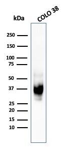 PMEL17/SILV Antibody (HMB45) - IHC-Prediluted Western Blot: PMEL17/SILV Antibody (HMB45) - IHC-Prediluted [NBP2-48316] -