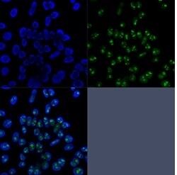 Nucleolin Antibody (NCL/902) - IHC-Prediluted Immunocytochemistry/ Immunofluorescence: Nucleolin Antibody (NCL/902) - IHC-Prediluted [NBP2-48317] -
