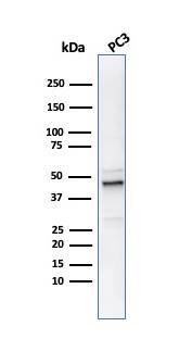 Ornithine Decarboxylase Antibody (ODC1/486) - IHC-Prediluted Western Blot: Ornithine Decarboxylase Antibody (ODC1/486) - IHC-Prediluted [NBP2-48321] -