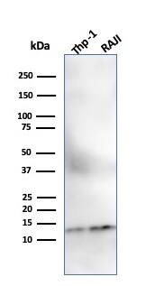 beta 2-Microglobulin Antibody (SPM617) - IHC-Prediluted Western Blot: beta 2-Microglobulin Antibody (SPM617) - IHC-Prediluted [NBP2-48328] -