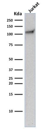 CD31/PECAM-1 Antibody (C31.10) - IHC-Prediluted Western Blot: CD31/PECAM-1 Antibody (C31.10) - IHC-Prediluted [NBP2-48330] -