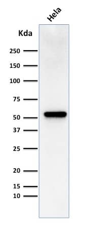Fascin Antibody (FSCN1/418) - IHC-Prediluted Western Blot: Fascin Antibody (FSCN1/418) - IHC-Prediluted [NBP2-48337] -