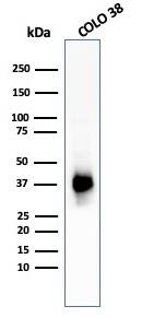 PMEL17/SILV Antibody (PMEL/783) - IHC-Prediluted Western Blot: PMEL17/SILV Antibody (PMEL/783) - IHC-Prediluted [NBP2-48341] -