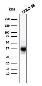 PMEL17/SILV Antibody (HMB45 + PMEL/783) - IHC-Prediluted Western Blot: PMEL17/SILV Antibody (HMB45 + PMEL/783) - IHC-Prediluted [NBP2-48342] -