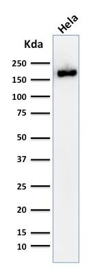 Podocalyxin Like Antibody (2A4) - IHC-Prediluted Western Blot: Podocalyxin Like Antibody (2A4) - IHC-Prediluted [NBP2-48344] -