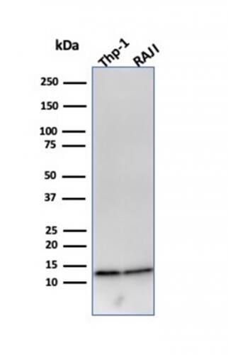 beta 2-Microglobulin Antibody (B2M/961) - IHC-Prediluted Western Blot: beta 2-Microglobulin Antibody (B2M/961) - IHC-Prediluted [NBP2-48345] -