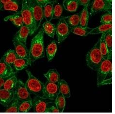beta 2-Microglobulin Antibody (B2M/961) - IHC-Prediluted Immunocytochemistry/ Immunofluorescence: beta 2-Microglobulin Antibody (B2M/961) - IHC-Prediluted [NBP2-48345] -