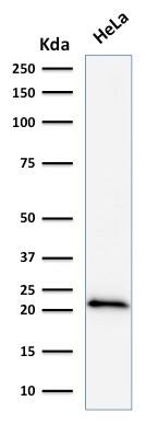 p21/CIP1/CDKN1A Antibody (DCS-60.2) - IHC-Prediluted Western Blot: p21/CIP1/CDKN1A Antibody (DCS-60.2) - IHC-Prediluted [NBP2-48351] -
