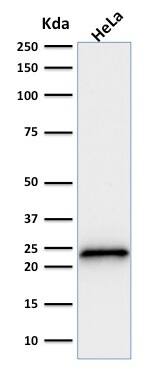 p21/CIP1/CDKN1A Antibody (SPM306) - IHC-Prediluted Western Blot: p21/CIP1/CDKN1A Antibody (SPM306) - IHC-Prediluted [NBP2-48352] -