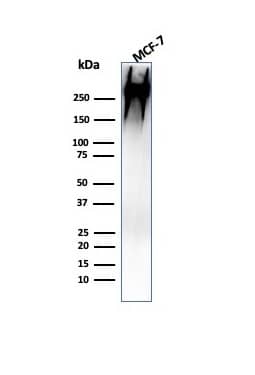MUC1 Antibody (MUC1/955) - IHC-Prediluted Western Blot: MUC1 Antibody (MUC1/955) - IHC-Prediluted [NBP2-48360] -