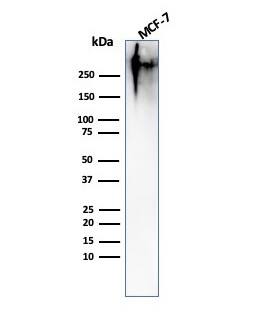 MUC1 Antibody (MUC1/967) - IHC-Prediluted Western Blot: MUC1 Antibody (MUC1/967) - IHC-Prediluted [NBP2-48361] -