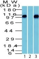 beta-Catenin Antibody - IHC-Prediluted Western Blot: beta-Catenin Antibody - IHC-Prediluted [NBP2-48367] -