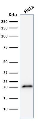 p21/CIP1/CDKN1A Antibody (CIP1/823) - IHC-Prediluted Western Blot: p21/CIP1/CDKN1A Antibody (CIP1/823) - IHC-Prediluted [NBP2-48371] -