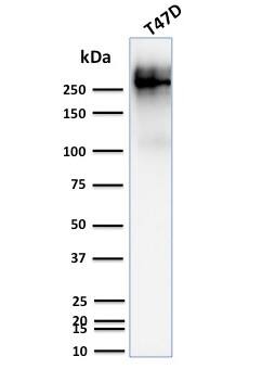 MUC1 Antibody (139H2) - IHC-Prediluted Western Blot: MUC1 Antibody (139H2) - IHC-Prediluted [NBP2-48378] -