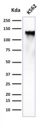 CD43/Sialophorin Antibody (SPN/839) - IHC-Prediluted Western Blot: CD43/Sialophorin Antibody (SPN/839) - IHC-Prediluted [NBP2-48379] -