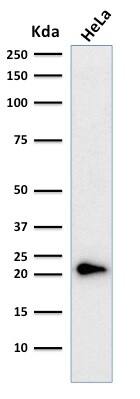 p21/CIP1/CDKN1A Antibody (CIP1/823 + DCS-60.2) - IHC-Prediluted Western Blot: p21/CIP1/CDKN1A Antibody (CIP1/823 + DCS-60.2) - IHC-Prediluted [NBP2-48384] -