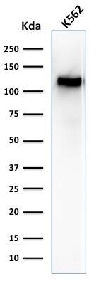 CD43/Sialophorin Antibody (SPN/1094) - IHC-Prediluted Western Blot: CD43/Sialophorin Antibody (SPN/1094) - IHC-Prediluted [NBP2-48394] -