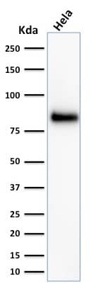 CD44 Antibody (HCAM/918) - IHC-Prediluted Western Blot: CD44 Antibody (HCAM/918) - IHC-Prediluted [NBP2-48408] -