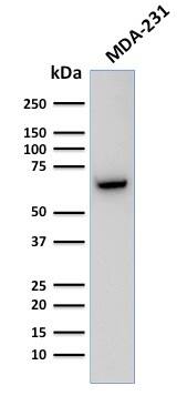 GnRHR Antibody (F1G4) - IHC-Prediluted Western Blot: GnRHR Antibody (F1G4) - IHC-Prediluted [NBP2-48419] -