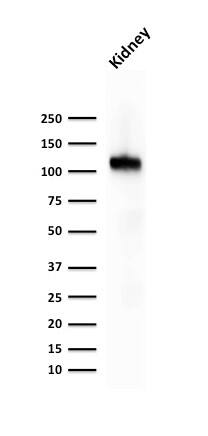 Cadherin-16 Antibody (CDH16/1071) - IHC-Prediluted Western Blot: Cadherin-16 Antibody (CDH16/1071) - IHC-Prediluted [NBP2-48433] -