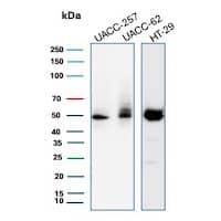 SOX10 Antibody (SOX10/991) - IHC-Prediluted Western Blot: SOX10 Antibody (SOX10/991) - IHC-Prediluted [NBP2-48436] -