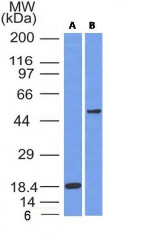 SOX10 Antibody (SOX10/991) - IHC-Prediluted Western Blot: SOX10 Antibody (SOX10/991) - IHC-Prediluted [NBP2-48436] -