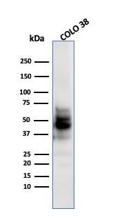 SOX10 Antibody (SPM607) - IHC-Prediluted Western Blot: SOX10 Antibody (SPM607) - IHC-Prediluted [NBP2-48444] -