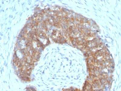TFF1/pS2 Antibody (SPM313) - IHC-Prediluted Immunohistochemistry-Paraffin: TFF1/pS2 Antibody (SPM313) - IHC-Prediluted [NBP2-48460] -