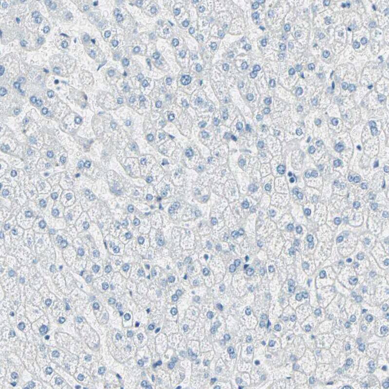 Nestin Antibody - BSA Free Immunohistochemistry-Paraffin: Nestin Antibody [NBP2-48504]