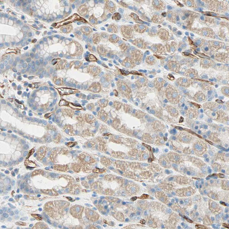 Nestin Antibody - BSA Free Immunohistochemistry-Paraffin: Nestin Antibody [NBP2-48504]