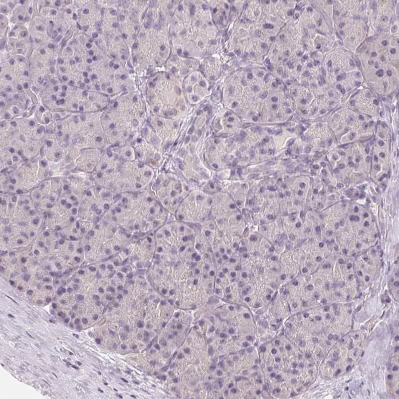 LC3A Antibody - BSA Free Immunohistochemistry-Paraffin: LC3A Antibody [NBP2-48512]