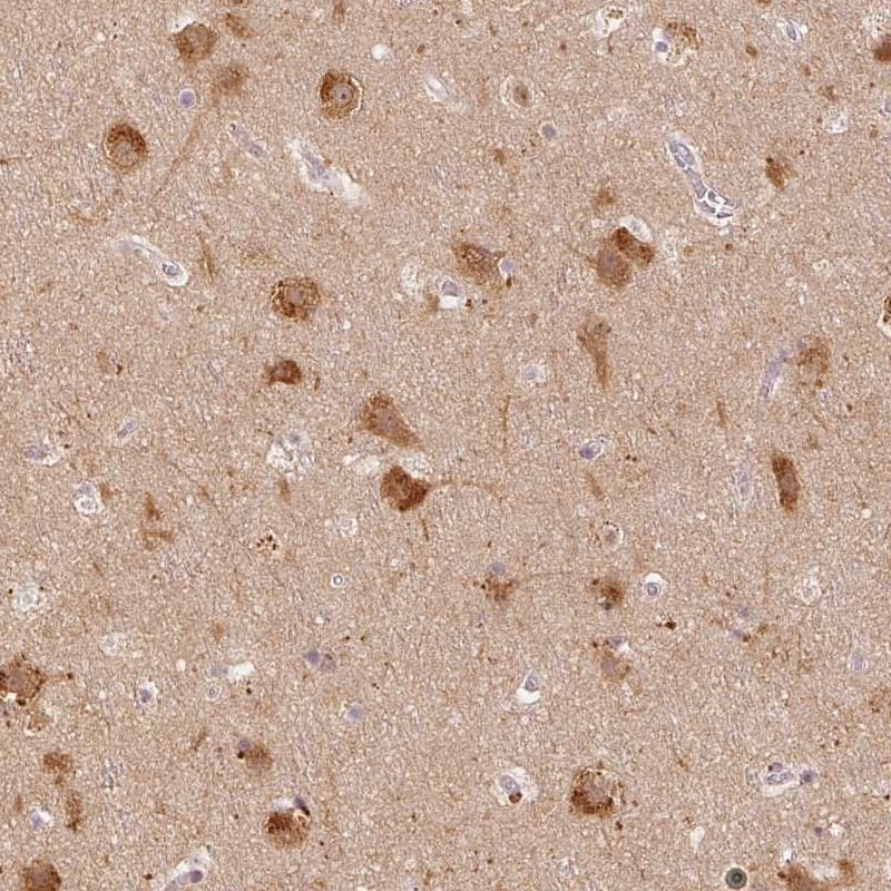 LC3A Antibody - BSA Free Immunohistochemistry-Paraffin: LC3A Antibody [NBP2-48512]
