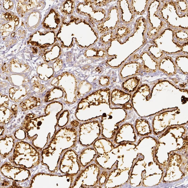 Perilipin-2/ADFP Antibody - BSA Free Immunohistochemistry-Paraffin: Perilipin-2/ADFP Antibody [NBP2-48532]