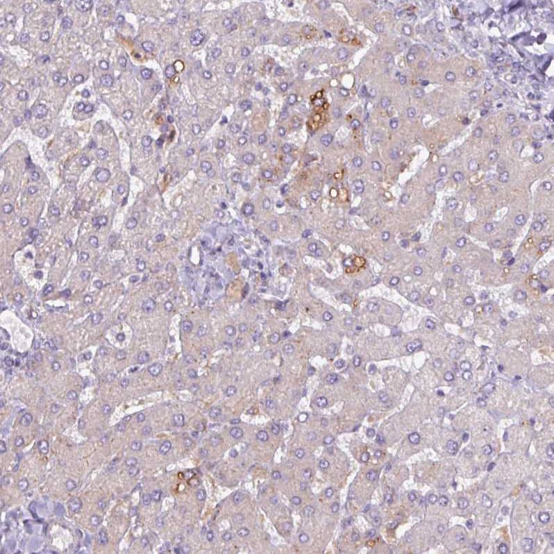 Perilipin-2/ADFP Antibody - BSA Free Immunohistochemistry-Paraffin: Perilipin-2/ADFP Antibody [NBP2-48532]