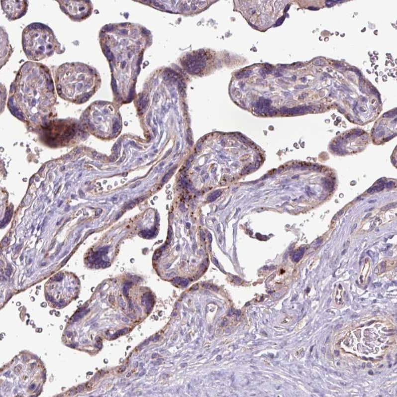 Perilipin-2/ADFP Antibody - BSA Free Immunohistochemistry-Paraffin: Perilipin-2/ADFP Antibody [NBP2-48532]