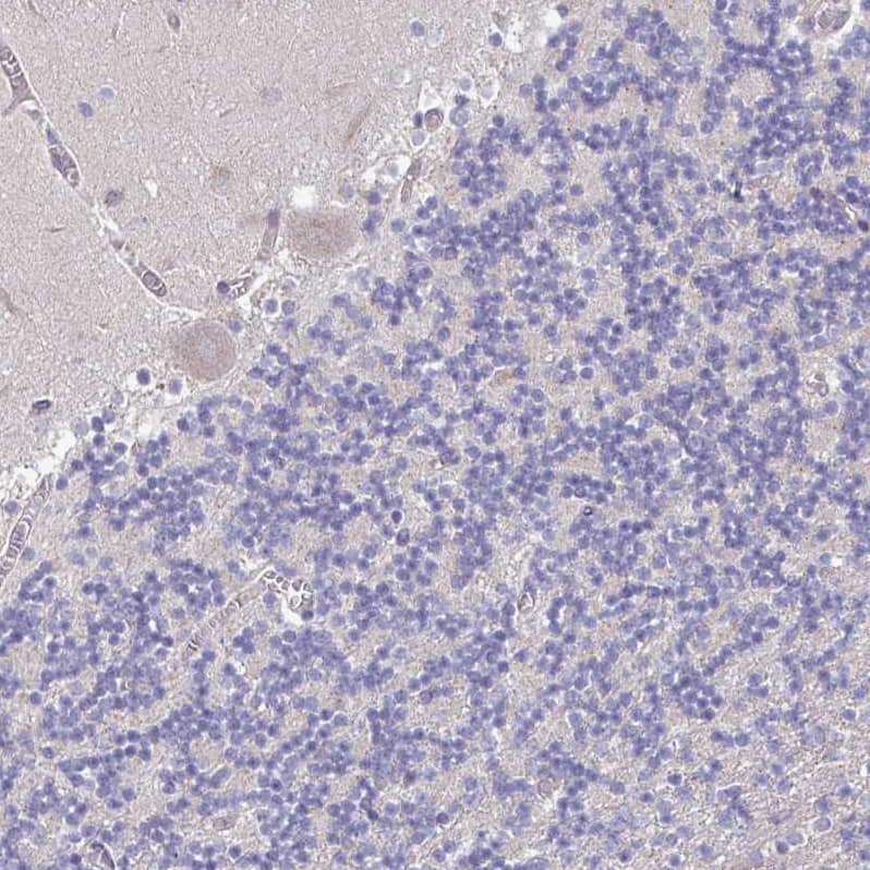 Perilipin-2/ADFP Antibody - BSA Free Immunohistochemistry-Paraffin: Perilipin-2/ADFP Antibody [NBP2-48532]