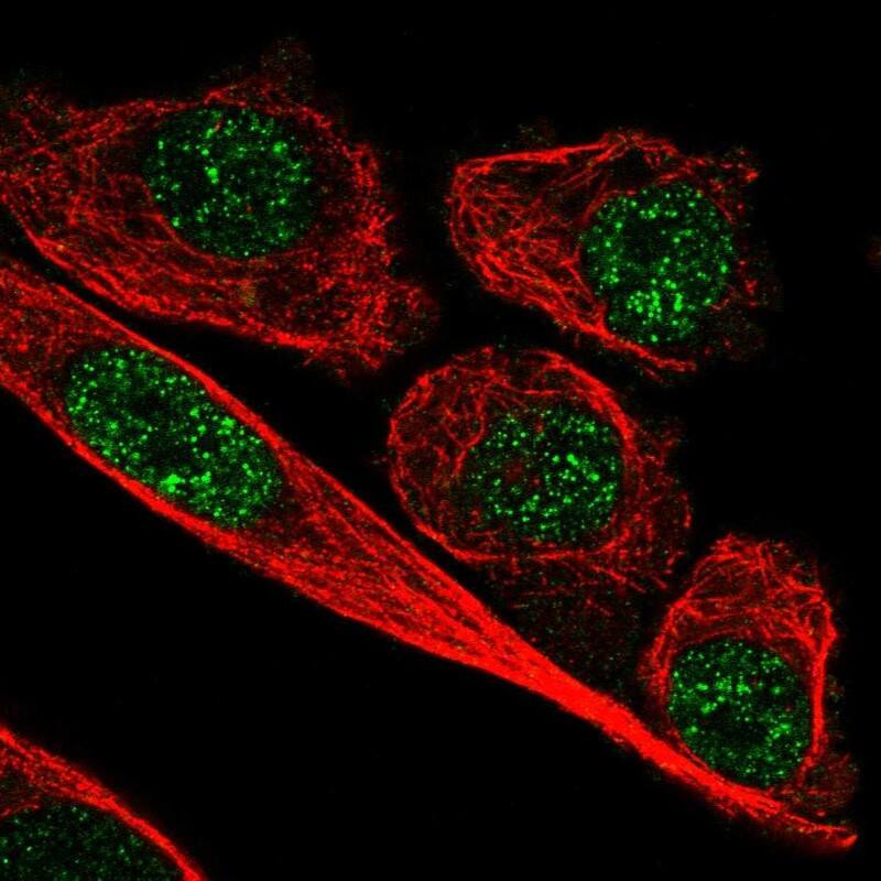 ZNF248 Antibody - BSA Free Immunocytochemistry/ Immunofluorescence: ZNF248 Antibody [NBP2-48538]