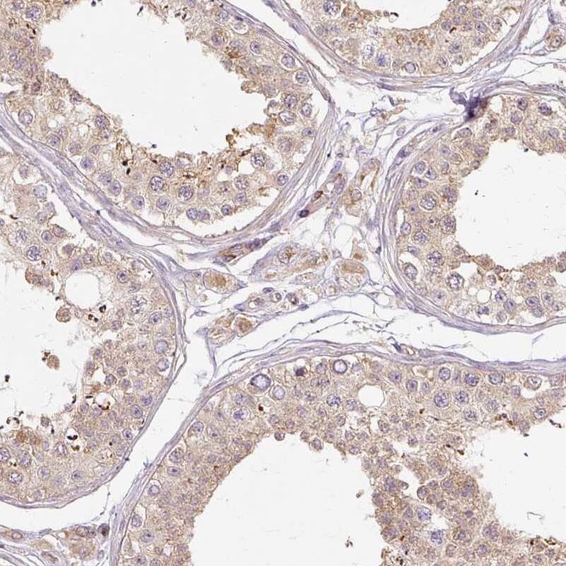 RB1CC1 Antibody - BSA Free Immunohistochemistry: RB1CC1 Antibody - BSA Free [NBP2-48572]