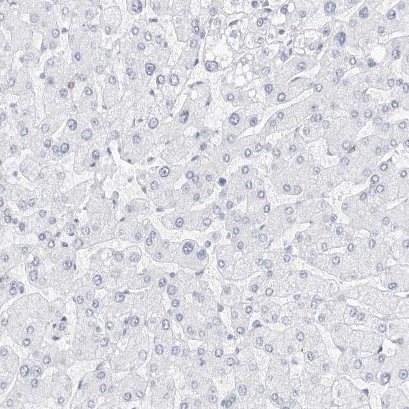 Nestin Antibody - BSA Free Immunohistochemistry-Paraffin: Nestin Antibody [NBP2-48575]
