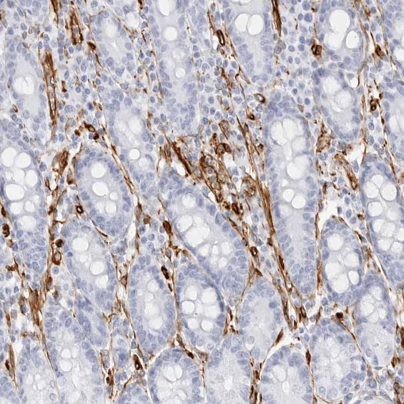 Nestin Antibody - BSA Free Immunohistochemistry-Paraffin: Nestin Antibody [NBP2-48575]