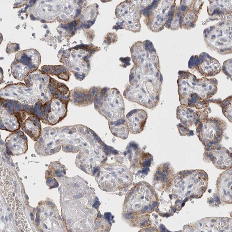 LYAG/GAA Antibody - BSA Free Immunohistochemistry-Paraffin: LYAG/GAA Antibody - BSA Free [NBP2-48576]