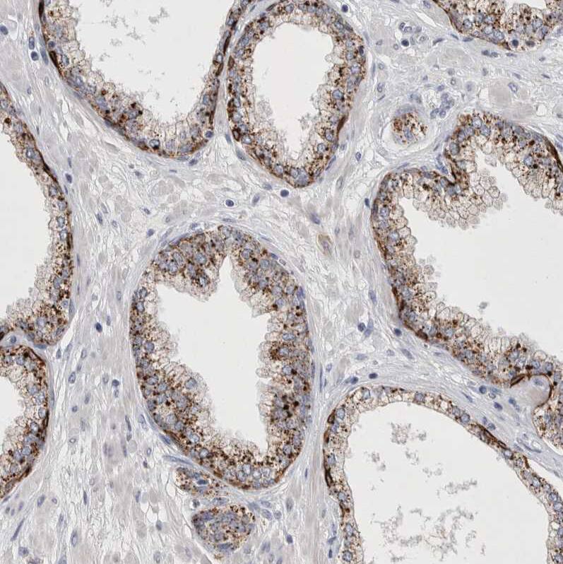 LYAG/GAA Antibody - BSA Free Immunohistochemistry-Paraffin: LYAG/GAA Antibody - BSA Free [NBP2-48576]