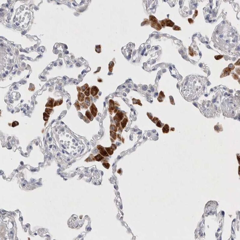 LYAG/GAA Antibody - BSA Free Immunohistochemistry-Paraffin: LYAG/GAA Antibody - BSA Free [NBP2-48576]