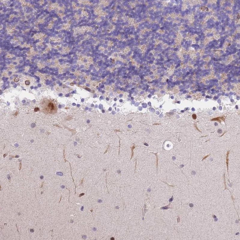 S100P binding protein Antibody - BSA Free Immunohistochemistry-Paraffin: S100P binding protein Antibody [NBP2-48580]