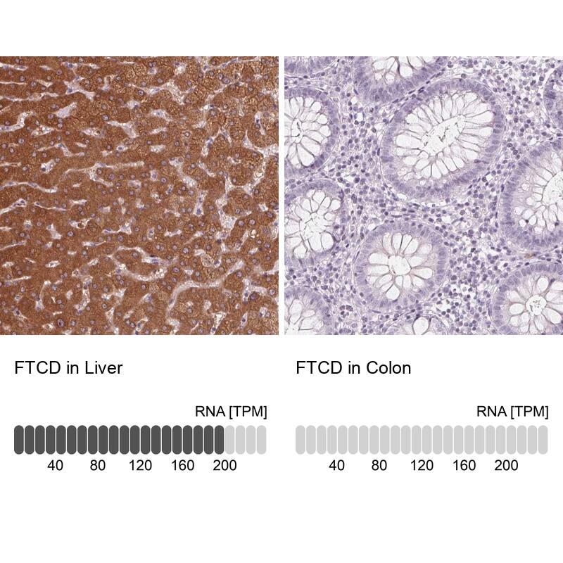 58K Golgi Protein Antibody - BSA Free Immunohistochemistry-Paraffin: 58K Golgi Protein Antibody [NBP2-48601]