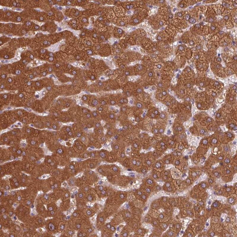 58K Golgi Protein Antibody - BSA Free Immunohistochemistry-Paraffin: 58K Golgi Protein Antibody [NBP2-48601]