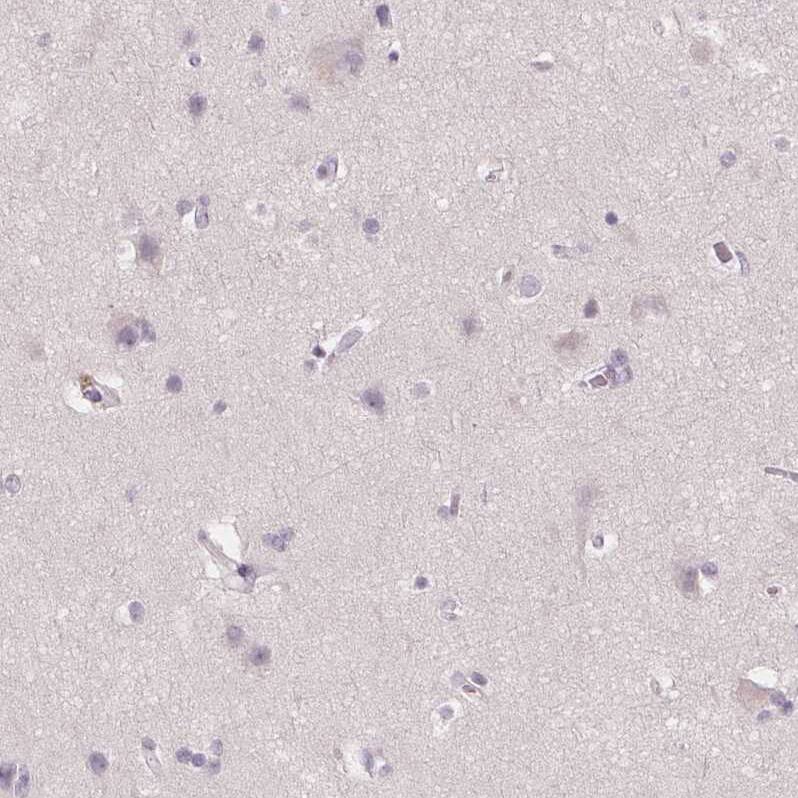 58K Golgi Protein Antibody - BSA Free Immunohistochemistry-Paraffin: 58K Golgi Protein Antibody [NBP2-48601]