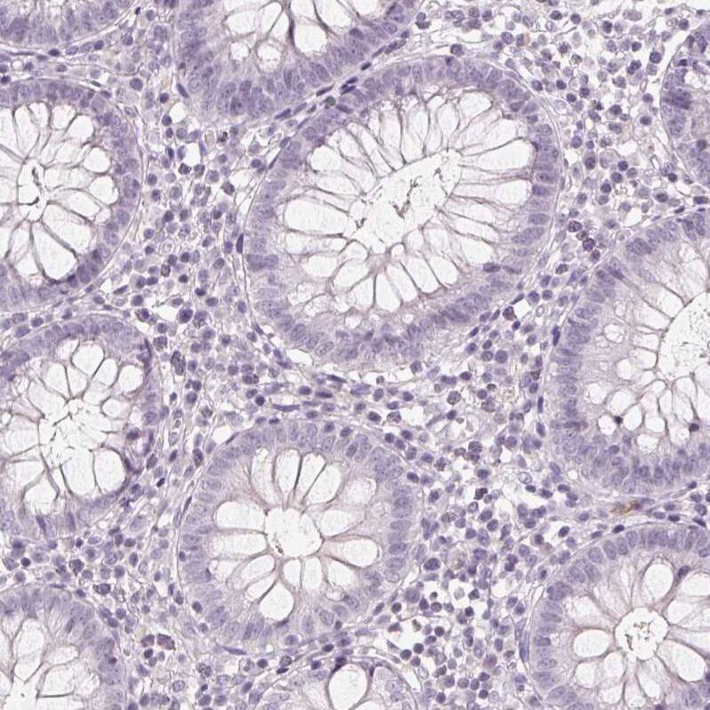 58K Golgi Protein Antibody - BSA Free Immunohistochemistry-Paraffin: 58K Golgi Protein Antibody [NBP2-48601]